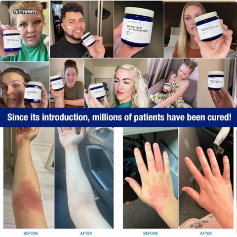 The Ocean Healed My Eczema Soothing Cream