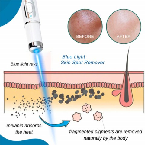 Blue light spot remover